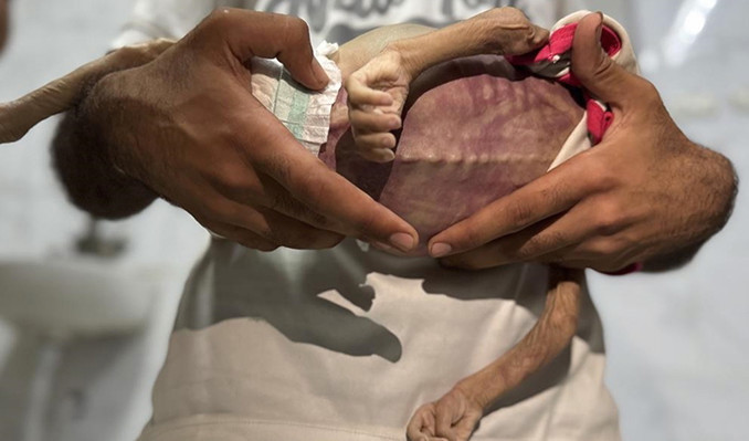 Gazze Şeridi’nde 127 kişi açlıktan hayatını kaybetti